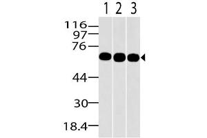 Image no. 1 for anti-Methyl-CpG Binding Domain Protein 1 (MBD1) (AA 291-586) antibody (ABIN5027347) (MBD1 抗体  (AA 291-586))