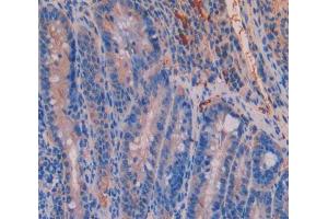 IHC-P analysis of Kidney tissue, with DAB staining. (UMPS 抗体  (AA 311-481))