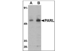 Western blot analysis of PARL in 3T3 cell lysate with PARL antibody at (A) 1 and (B) 2 µg/ml. (PARL 抗体  (N-Term))