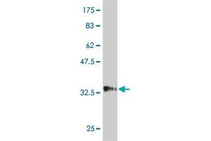 Western Blot detection against Immunogen (34. (HAND2 抗体  (AA 135-216))
