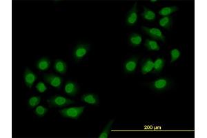 Immunofluorescence of monoclonal antibody to SMAD4 on HeLa cell. (SMAD4 抗体  (AA 1-552))