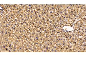 Detection of CAT in Mouse Liver Tissue using Polyclonal Antibody to Catalase (CAT)