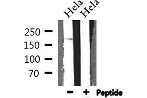 Western blot analysis of extracts from Hela, using BCOR Antibody. (BCOR 抗体  (Internal Region))