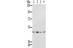 Western Blotting (WB) image for anti-Sjogren Syndrome Antigen B (SSB) antibody (ABIN2433932) (SSB 抗体)