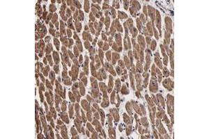 Immunohistochemical staining of human heart muscle with PSMA3 polyclonal antibody  shows moderate cytoplasmic positivity in myocytes. (PSMA3 抗体)