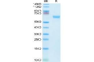 Mouse CD27 on Tris-Bis PAGE under reduced condition. (CD27 Protein (AA 24-182) (mFc Tag))