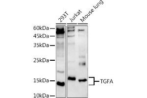 Western blot analysis of extracts of various cell lines, using TGFA antibody (ABIN3020947, ABIN3020948, ABIN3020949, ABIN1513602 and ABIN6213813) at 1:500 dilution. (TGFA 抗体  (AA 24-98))