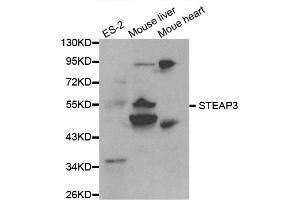 Western blot analysis of extracts of various cell lines, using STEAP3 antibody. (STEAP3 抗体)