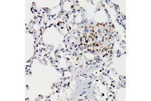Immunohistochemistry of paraffin-embedded rat lung using HD Rabbit pAb (ABIN3022053, ABIN3022054, ABIN3022055 and ABIN6218586) at dilution of 1:25 (40x lens). (HDAC9 抗体  (AA 1-100))