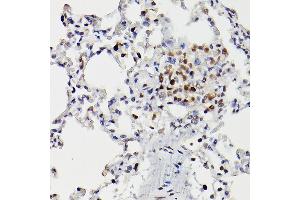 Immunohistochemistry of paraffin-embedded rat lung using HD Rabbit pAb (ABIN3022053, ABIN3022054, ABIN3022055 and ABIN6218586) at dilution of 1:25 (40x lens).
