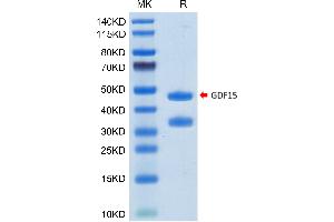 SDS-PAGE (SDS) image for Growth Differentiation Factor 15 (GDF15) (AA 197-308) protein (Fc Tag) (ABIN7274725)
