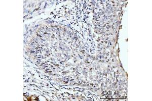 IHC analysis of SBNO1 using anti-SBNO1 antibody (ABIN7601710). (SBNO1 抗体  (AA 43-1303))