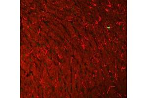 IF analysis of Histone H3 and GFAP using anti-Histone H3 antibody  and anti-GFAP antibody (ABIN7602675). (GFAP 抗体  (AA 93-432))