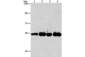 Western Blot analysis of Human bladder carcinoma tissue and A172 cell, Human fetal brain tissue and hela cell using PDE4D Polyclonal Antibody at dilution of 1:500 (PDE4D 抗体)