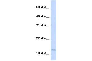 WB Suggested Anti-CRABP2 Antibody Titration:  0. (CRABP2 抗体  (Middle Region))