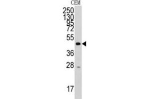 Western Blotting (WB) image for anti-Tyrosyl-tRNA Synthetase 2, Mitochondrial (YARS2) antibody (ABIN3003520) (YARS2 抗体)