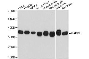 Western blot analysis of extracts of various cell lines, using GAPDH antibody. (GAPDH 抗体)