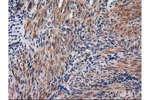 Immunohistochemical staining of paraffin-embedded Human endometrium tissue using anti-NNMT mouse monoclonal antibody. (NNMT 抗体)
