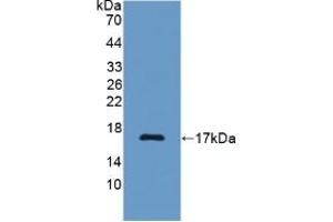 Detection of Recombinant C7, Rat using Polyclonal Antibody to Complement Component 7 (C7) (C7 抗体  (AA 1-144))