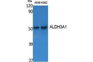 Western Blotting (WB) image for anti-Aldehyde Dehydrogenase 3 Family, Member A1 (ALDH3A1) (Internal Region) antibody (ABIN3187594) (ALDH3A1 抗体  (Internal Region))