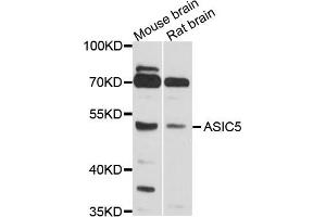 Western blot analysis of extract of mouse brain and rat brain cells, using ASIC5 antibody. (ACCN5 抗体)
