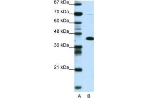 Western Blotting (WB) image for anti-Zinc Finger and BTB Domain Containing 25 (ZBTB25) antibody (ABIN2460742) (ZBTB25 抗体)