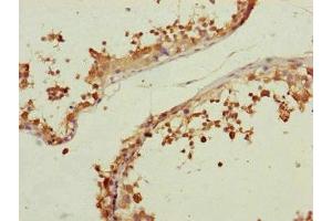 Immunohistochemistry of paraffin-embedded human testis tissue using ABIN7147357 at dilution of 1:100 (CETN3 抗体  (AA 1-167))