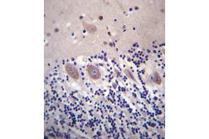 Immunohistochemistry (Paraffin-embedded Sections) (IHC (p)) image for anti-Calcium Channel, Voltage-Dependent, alpha 2/delta Subunit 2 (CACNA2D2) (AA 643-671) antibody (ABIN657303)