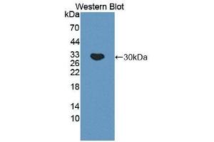 Detection of Recombinant C4BPa, Mouse using Polyclonal Antibody to C4 Binding Protein Alpha (C4BPa) (C4BPA 抗体  (AA 57-306))