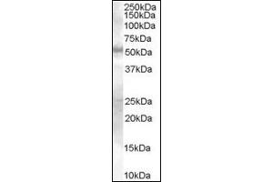 Image no. 1 for anti-SMAD Family Member 9 (SMAD9) (Internal Region) antibody (ABIN372891) (SMAD9 抗体  (Internal Region))