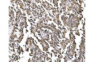 IHC analysis of NOLA1/GAR1 using anti-NOLA1/GAR1 antibody (ABIN7602076).