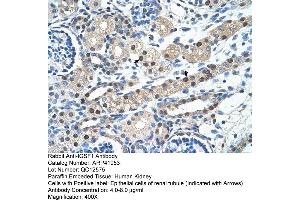 Rabbit Anti-IGSF1 Antibody  Paraffin Embedded Tissue: Human Kidney Cellular Data: Epithelial cells of renal tubule Antibody Concentration: 4. (IGSF1 抗体  (N-Term))