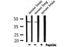 Western blot analysis of extracts from mouse brain, mouse lung, using CEACAM16 Antibody. (CEACAM16 抗体  (Internal Region))