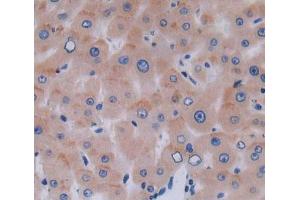 Used in DAB staining on fromalin fixed paraffin- embedded liver tissue (DAAM1 抗体  (AA 1-250))