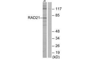 Western blot analysis of extracts from Jurkat cells, using RAD21 antibody. (RAD21 抗体)