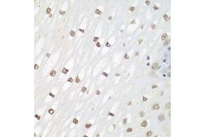 Immunohistochemistry of paraffin-embedded human esophagus using FOSL2 antibody (ABIN3016548, ABIN3016549, ABIN3016550 and ABIN6219779) at dilution of 1:100 (40x lens). (FOSL2 抗体  (AA 187-326))