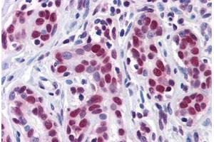 Human Breast: Formalin-Fixed, Paraffin-Embedded (FFPE) (ELAVL1 抗体  (AA 1-101))