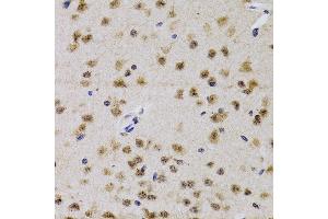 Immunohistochemistry of paraffin-embedded mouse brain using CDK7 antibody (ABIN3022404, ABIN3022405, ABIN3022406 and ABIN6218792) at dilution of 1:200 (40x lens). (CDK7 抗体  (AA 1-346))