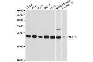 Western blot analysis of extracts of various cell lines, using NOP16 antibody (ABIN6293674) at 1:3000 dilution. (NOP16 抗体)