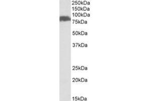 Western Blotting (WB) image for anti-Solute Carrier Family 26, Member 6 (SLC26A6) (Internal Region) antibody (ABIN1449464) (SLC26A6 抗体  (Internal Region))
