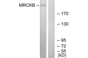 Western Blotting (WB) image for anti-CDC42 Binding Protein Kinase beta (DMPK-Like) (CDC42BPB) (C-Term) antibody (ABIN1850128) (CDC42BPB 抗体  (C-Term))
