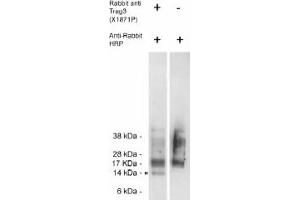Image no. 1 for anti-CSAG Family, Member 2 (CSAG2) antibody (ABIN265186) (CSAG2 抗体)