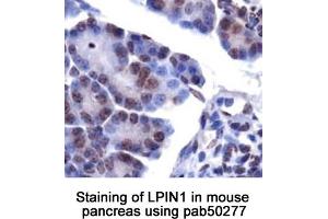 Image no. 1 for anti-Lipin 1 (LPIN1) (AA 300-400), (Internal Region) antibody (ABIN363586) (Lipin 1 抗体  (Internal Region))