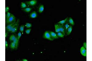 Immunofluorescent analysis of HepG2 cells using ABIN7142825 at dilution of 1:100 and Alexa Fluor 488-congugated AffiniPure Goat Anti-Rabbit IgG(H+L) (RPL4 抗体  (AA 12-91))