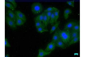 Immunofluorescence staining of HepG2 cells with ABIN7147234 at 1:50, counter-stained with DAPI. (CDK5RAP3 抗体  (Regulatory Subunit))