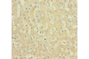 Immunohistochemistry (IHC) image for anti-Ferritin, Light Polypeptide (FTL) (AA 2-175) antibody (ABIN7152719)