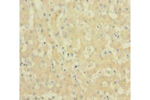 Immunohistochemistry of paraffin-embedded human liver tissue using ABIN7152719 at dilution of 1:100 (FTL 抗体  (AA 2-175))