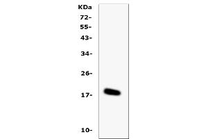 Western blot analysis of IL-16 using anti-IL-16 antibody (ABIN5518927).