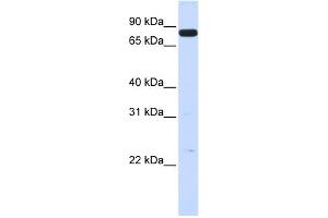 WB Suggested Anti-HGF Antibody Titration:  0. (HGF 抗体  (N-Term))