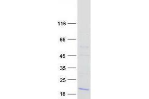 Trafficking Protein Particle Complex 2 (TRAPPC2) (Transcript Variant 2) protein (Myc-DYKDDDDK Tag)
